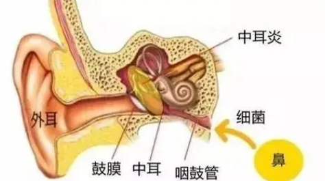 流脓才是中耳炎？这样的误区你踩了多少？