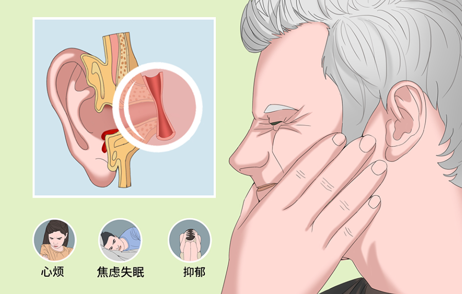 想要缓解耳鸣？这两种食物一定要少吃